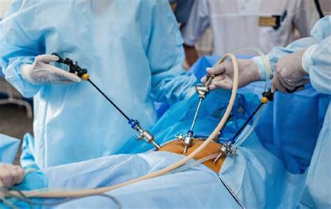 Keistimewaan Operasi Urologi di Kota Makassar